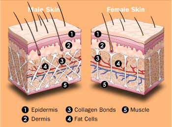 Why cellulite happens in females more than males